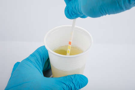 Medical Urine Test Examined By Doctor With The Help Of Urine Test Strip