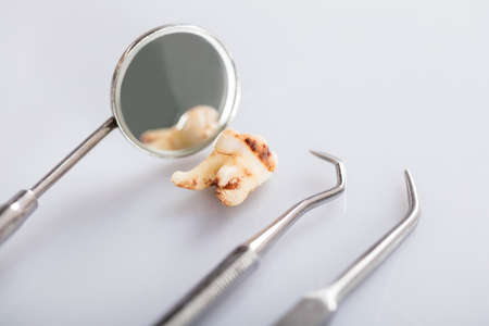 Close-up Of Decay Tooth With Dental Tools Over Gray Background