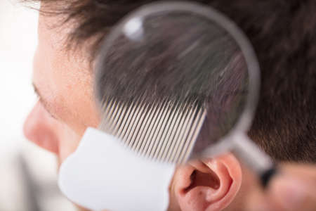 Close-up Of Dermatologist Looking At Male Patient's Hair Through Magnifying Glass