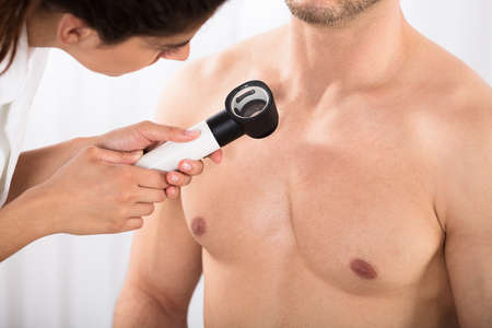 Close-up Of A Doctor Examining Young Man's Shoulder With Dermatoscopeの写真素材