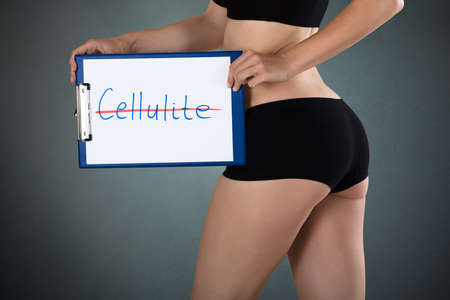 Beautiful Young Woman Holding A Clipboard With Text Cellulite