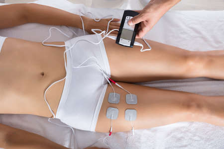 High Angle View Of A Therapist Giving Electrodes Therapy On Woman's Thighの写真素材