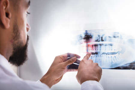 Close-up Of A Dentist's Hand Examining Teeth X-ray