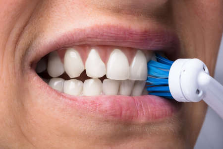 Close-up Of A Woman's Teeth With Electrical Toothbrushの写真素材