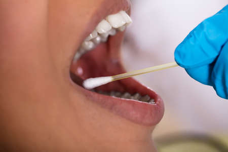 Close-up Of A Dentist's Hand Making Saliva Test On The Mouth With Cotton Swabの写真素材