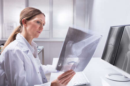 Mature Female Doctor Examining Knee X-ray In Clinicの写真素材