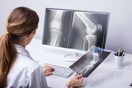 Mature Female Doctor Examining Knee X-ray In Clinicの写真素材
