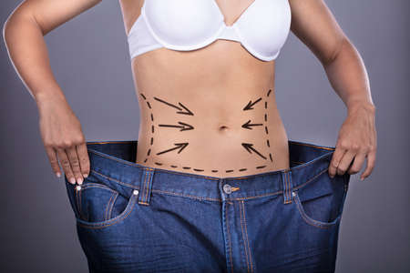 Woman With Correction Lines On Belly Showing Weightloss By Wearing Old Jeansの写真素材