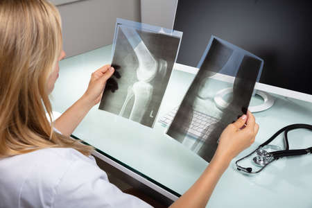 Close-up Of A Female Doctor Examining Knee X-ray In Clinic
