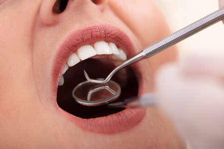 Close-up Of A Woman Going Through Dental Treatment In Clinic