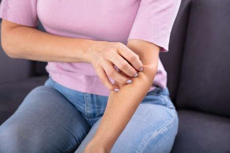 Close-up Of A Woman's Hand Scratching The Itch On Her Arm