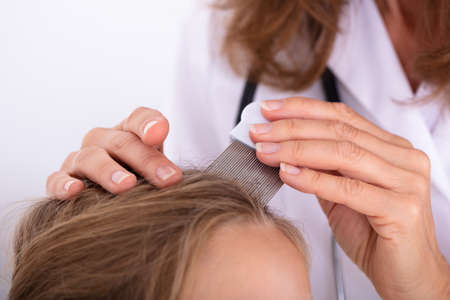 Close-up Of A Doctor Examining Girl's Hair With Combの写真素材