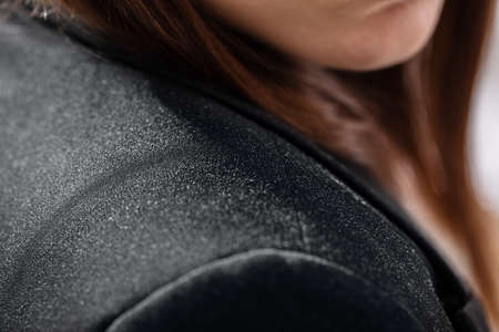 Close-up Of A Businesswoman In Black Suit With Dandruff On His Shoulderの写真素材
