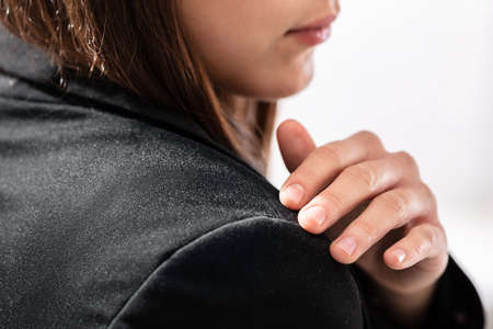 Close-up Of A Businesswoman Cleaning Dandruff Off The Shoulder