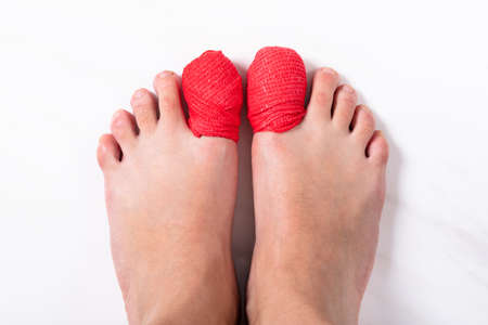 Close-up Of Human's Leg With Red Bandage On Sore Toe Nail
