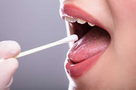 Dentist's Hand Taking Saliva Test From Woman's Mouth With Cotton Swab