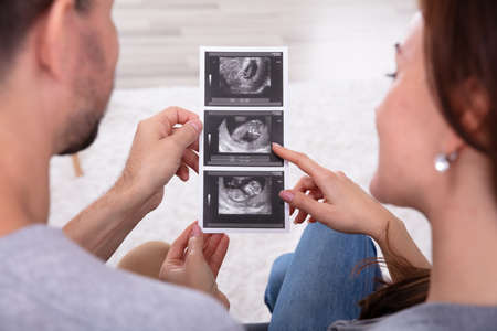 Close-up Of A Expectant Couple Looking At Ultrasound Scan Reportの写真素材