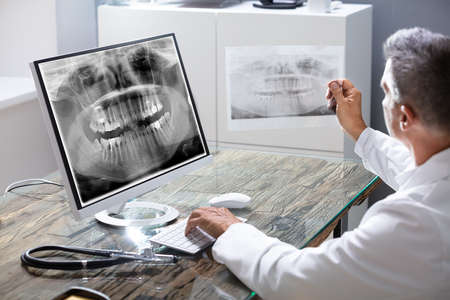 Close-up Of A Dentist's Hand Examining Teeth X-ray On Computer