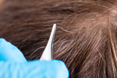 Close-up Of Hand Plucking Gray Hair With Tweezersの写真素材