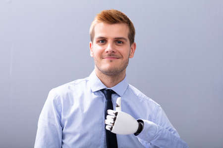 Businessperson With Prosthetic Limb Showing Thumb Up. Artificial Limbの写真素材