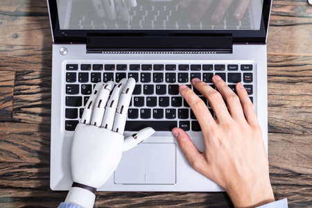 Man With Prosthetic Hand Working On Laptop. Artificial Limbの写真素材