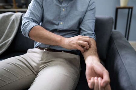 Close-up Of An African Man Scratching His Hand