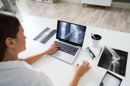 Doctor Looking At Foot X-ray On Laptop With Stethoscope の写真素材