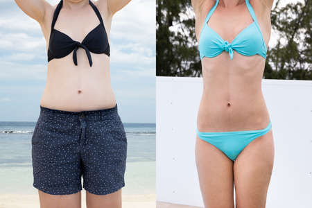 Woman Before And After From Fat To Slim Concept Standing