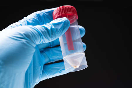 Doctor Hand With Plastic Container Sampling Of Fecesの写真素材