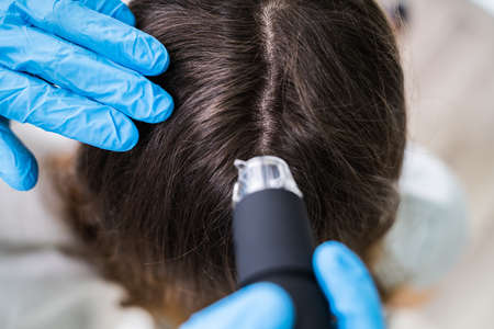 Close-up Of Dermatologist Using Trichoscope For Hair Fall Treatment His Clinicの写真素材
