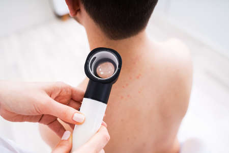 Close-up Of Person Hands Examining Acne Skin Of Man With Dermatoscope