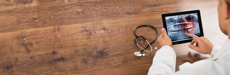 Dentist Doctor Looking At Jaw Tooth Dental Xrayの写真素材