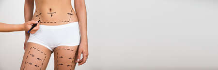 Cosmetic Plastic Surgery And Liposuction Aesthetic Procedureの写真素材