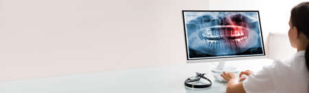 Dentist Using Computer Technology Dental Software For Teeth Xrayの写真素材