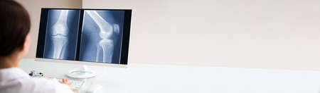 Surgeon Doctor Looking At Knee Bone Xray