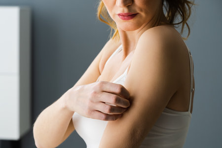 Woman Scratching Itching Body Skin With Allergy