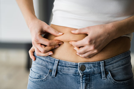 Stomach Fat Liposuction And Diet. Stomach Skin Pinchの写真素材