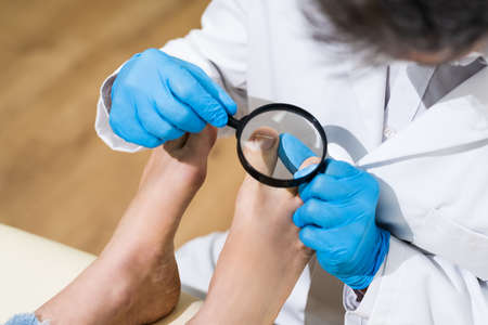 Ingrown Toenail Problem. Infected Patient Foot Check