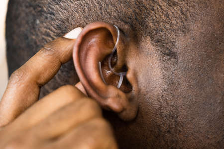 Hearing Aid And Audiology. Handicap And Disability Aidの写真素材