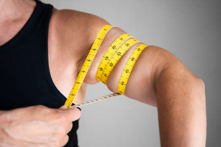 Overweight Female Arm Cellulite Measure Before Surgery