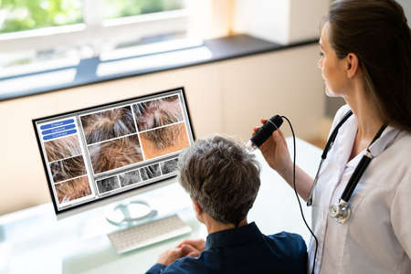 Hair Scalp Analysis In Clinic. Man With Hair Fall And Dandruffの写真素材