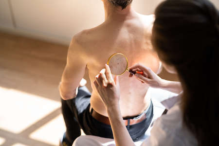 Dermatologist Checking Skin Allergy And Pigment Problemsの写真素材