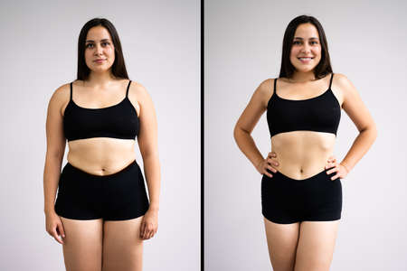 Woman Before And After Weight Loss On Gray Background. Body Shape Was Altered During Retouchingの写真素材