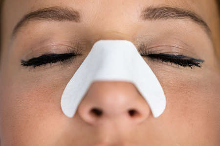 Female Portrait With Nose Strip To Clean Skinの写真素材