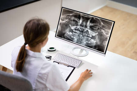 Radiologist Dentist Using X Ray Software On Desktop Computer