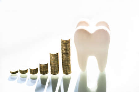 Dental Insurance And Dentist Bill Cost. Save Money On Implant