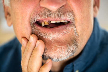 Close-up Of A Man Having Tooth Problemの写真素材