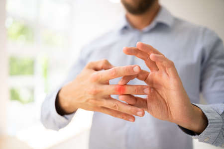 Finger Joint Arthritis. Hand Rheumatism Ache. Bone Fractureの写真素材