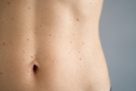 Woman Body Skin Rash With Red Allergy Eruption