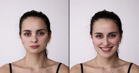 Before After Young Woman Aesthetic Facelift. Rhinoplasty Nose And Mid Face Surgeryの写真素材